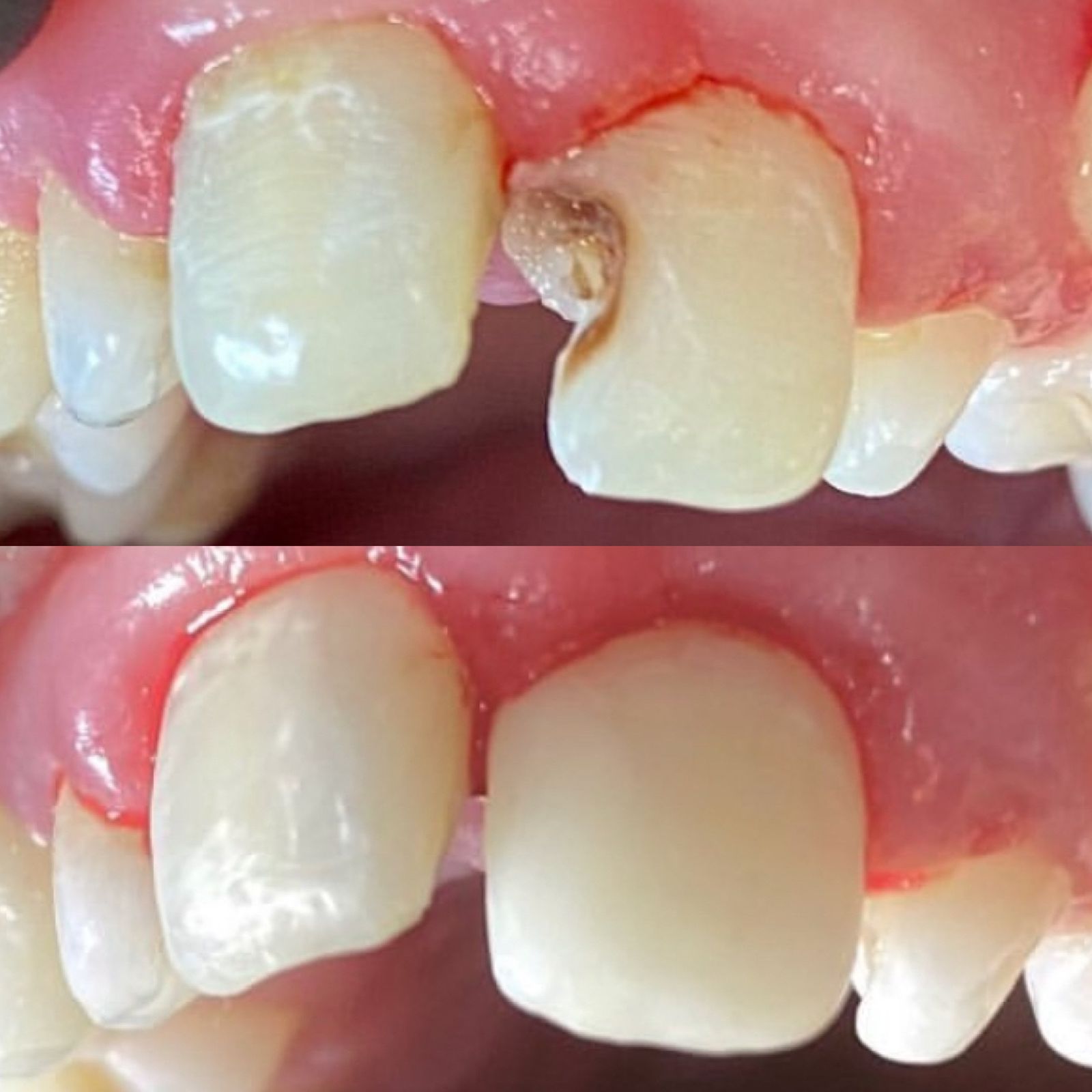 Sorriso estético
