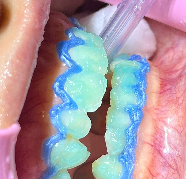 Dentes brancos e sorriso iluminado