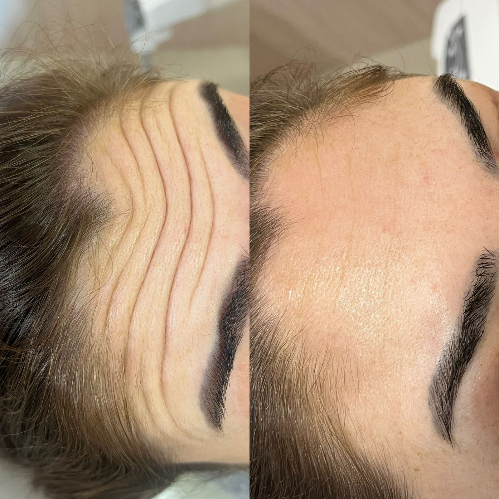 Estética e cuidados faciais