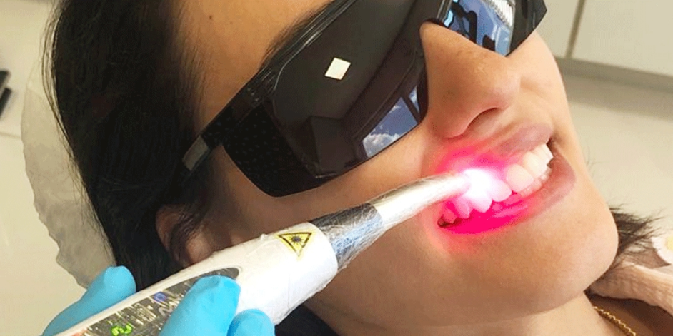 Aplicação de laser odontológico