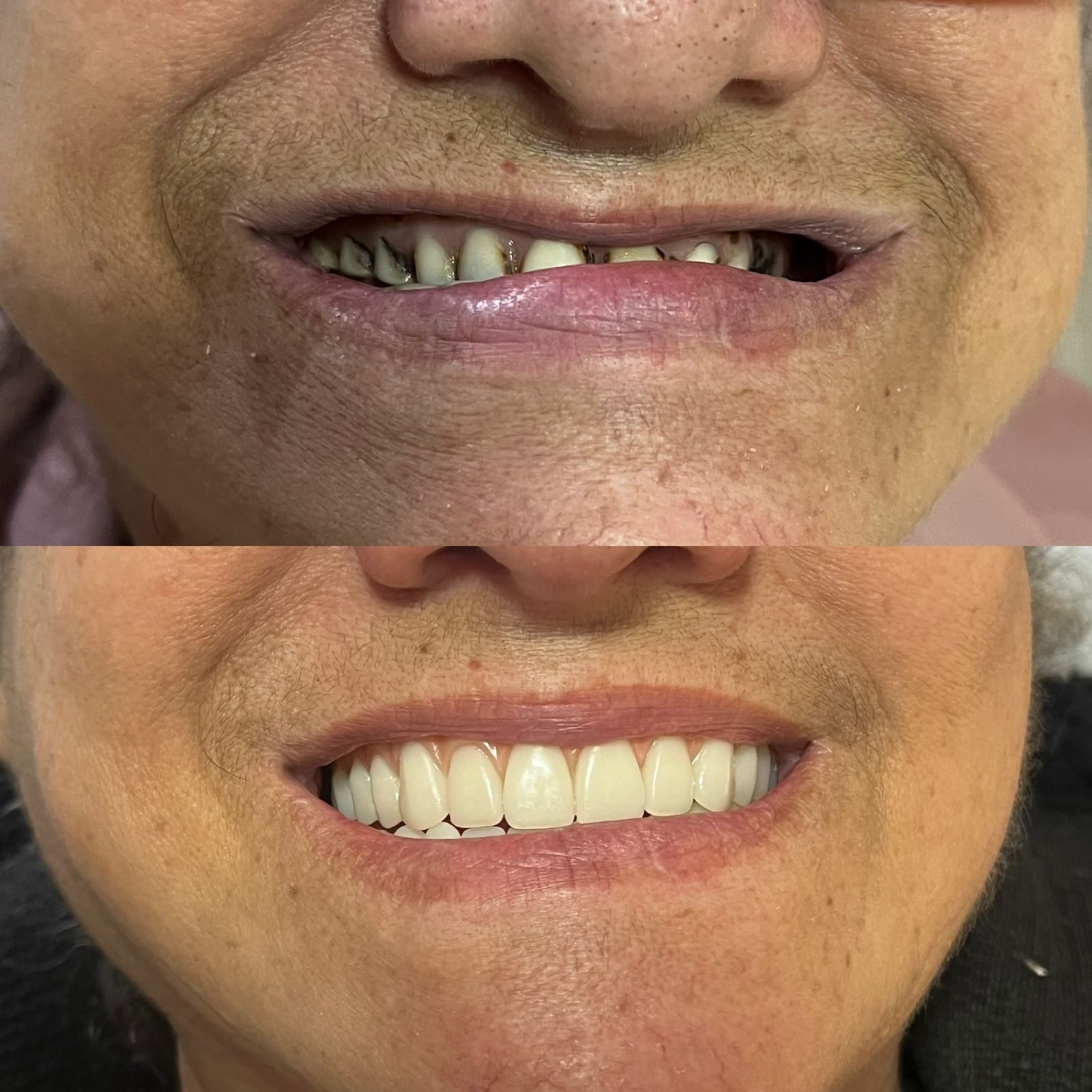 Pessoa sorrindo com confiança